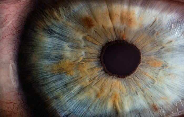 Iridology: An Insight into Your Health Through the Eyes